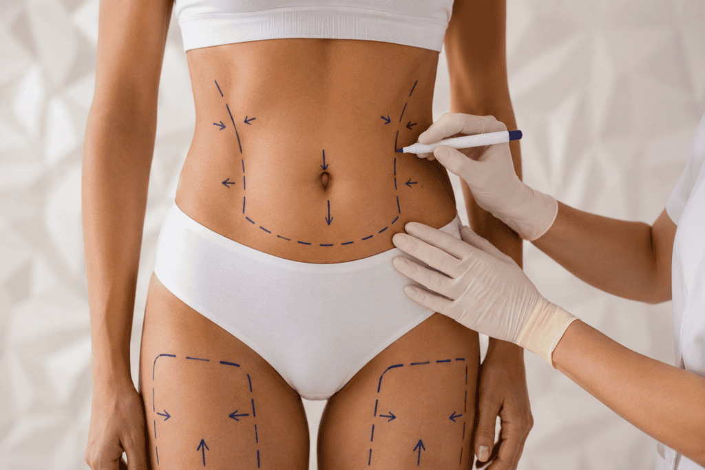 Bonita figura gracias a la mesoterapia corporal en Pamplona